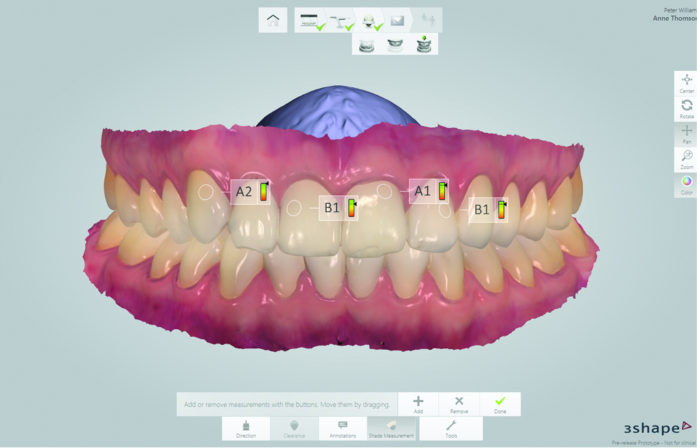 3SHAPE une technologie intuitive d'empreinte numérique au catalogue de Dentaire service